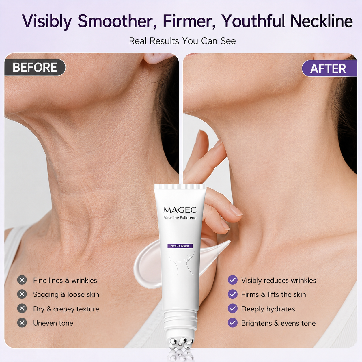 Last Day 49% OFF 🧴 2026 Roller Massage Neck Cream | Firms Neck, Reduces Wrinkles & Double Chin